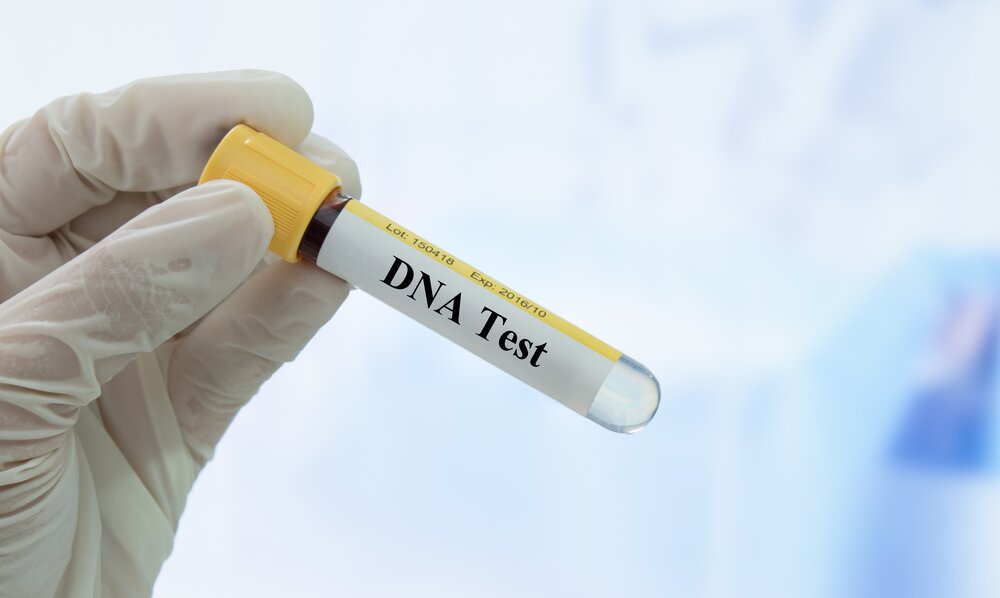 Assure DNA Review